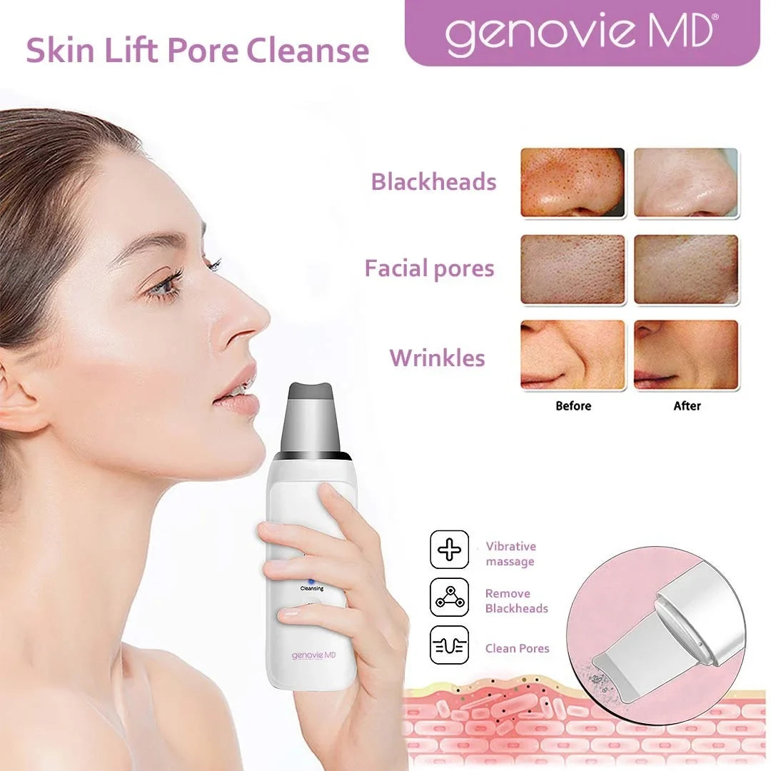 Acne Remover, Spatula, Cleaning MD Deep Removal Genovie Cleanse, Blackhead Skin Pore And Face Facial Tool, Scrubber